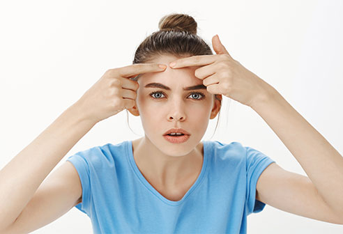 10 Steps to Get Rid of Acne Naturally