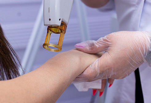 Caution Before Laser Hair Removal: Don't Compromise Your Health