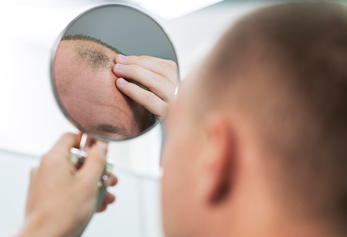 What You Wonder About Hair Loss